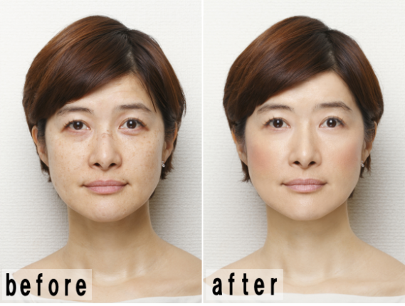 ハリウッドエアーのビフォア＆アフター