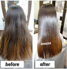 before＆after写真