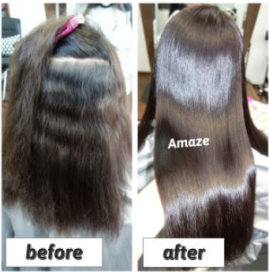 before＆after写真