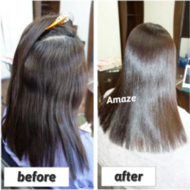 before＆after写真